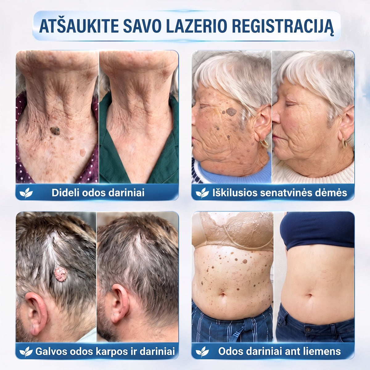 🪶🌟Oficiali parduotuvė | ✅️👩‍⚕️ 𝐇𝐈𝐒𝐊𝐈𝐍® 7 dienų odos išaugų ir dėmių šalinimo priemonė (𝐫𝐨𝐥𝐥-𝐨𝐧 𝐚𝐩𝐥𝐢𝐤𝐚𝐭𝐨𝐫𝐢𝐮𝐬: 𝐛𝐞 𝐬𝐤𝐚𝐮𝐬𝐦𝐨 𝐢𝐫 𝐫𝐚𝐧𝐝ų) 🌳