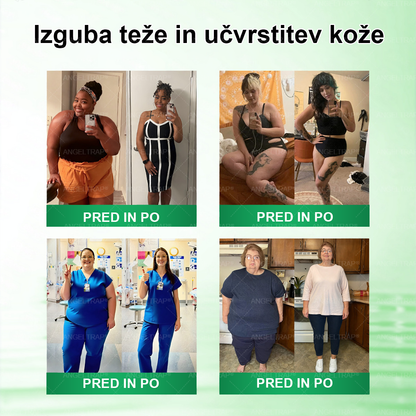 📢📢ANGELTRAP® Moringa × Berberin × AMPK 10-v-1 Metabolična podpora, obliž z nanotehnologijo mikroiglic 🇸🇮 (Dovolj je enkrat na dan, vidni rezultati v 7 dneh) ✅ Za debelost, ohlapno kožo, sladkorno bolezen, spalno apnejo, težave s sklepi in številne druge