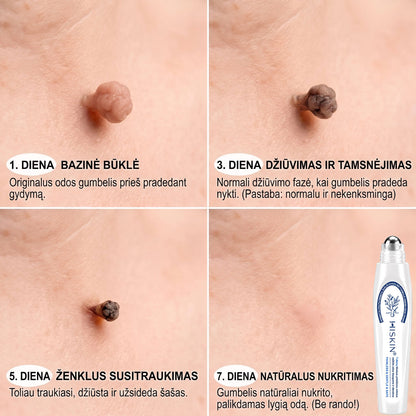 🪶🌟Oficiali parduotuvė | ✅️👩‍⚕️ 𝐇𝐈𝐒𝐊𝐈𝐍® 7 dienų odos išaugų ir dėmių šalinimo priemonė (𝐫𝐨𝐥𝐥-𝐨𝐧 𝐚𝐩𝐥𝐢𝐤𝐚𝐭𝐨𝐫𝐢𝐮𝐬: 𝐛𝐞 𝐬𝐤𝐚𝐮𝐬𝐦𝐨 𝐢𝐫 𝐫𝐚𝐧𝐝ų) 🌳